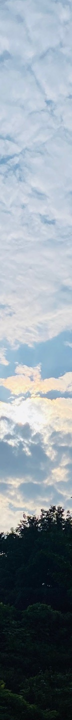 중년눈밑지방 눈꺼풀이 계속 처진다면? 관련 이미지 22