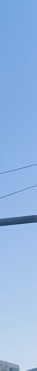 쌍수재수술가격 자연스러운 눈으로 관련 이미지 21