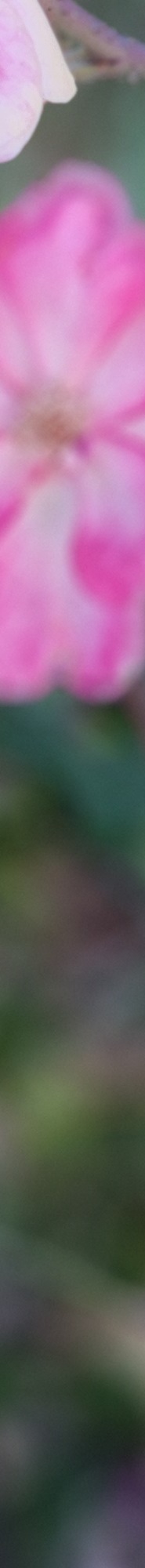 인중축소후기 비율에 맞는 예쁜 입술라인을 위해 관련 이미지 26