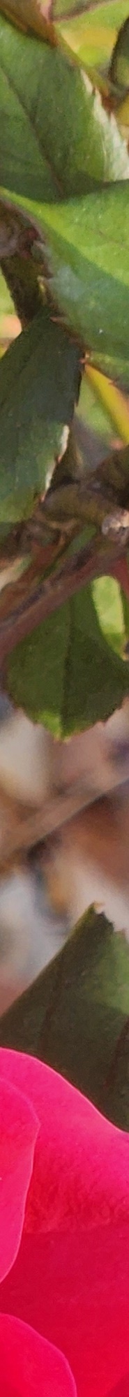 Double Eyelid Revision Surgery, My Own Money, Final Eye Plastic Surgery image 27