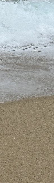 인중코성형후기 내 코에 맞는 핏한 수술 관련 이미지 27