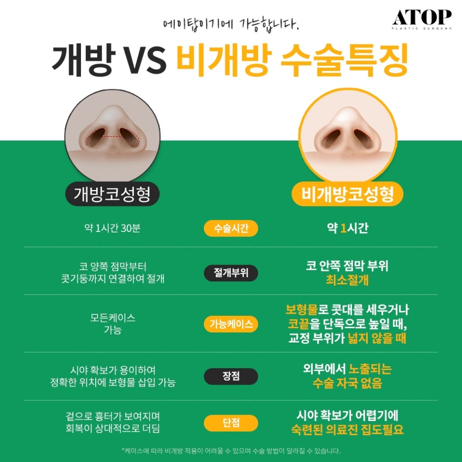비절개코성형후기 흉터를 감춰 자연스러운 모습 관련 이미지 3
