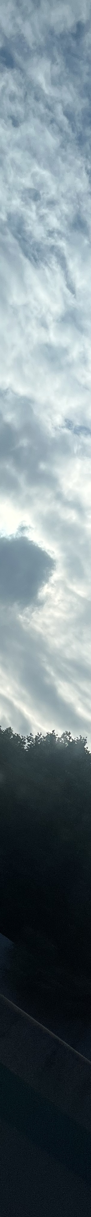 짝눈재수술, 눈매교정 같이 해야할까 관련 이미지 23