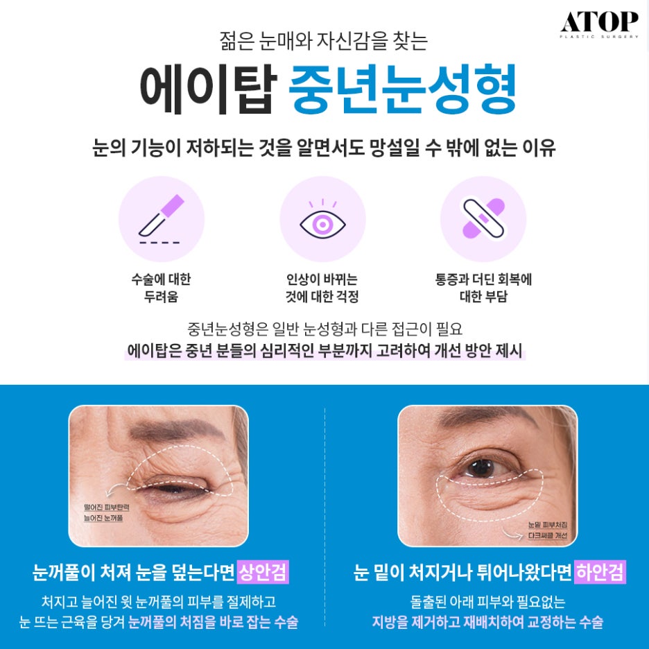 처진눈수술 중년의 눈을 또렷하게 관련 이미지 2