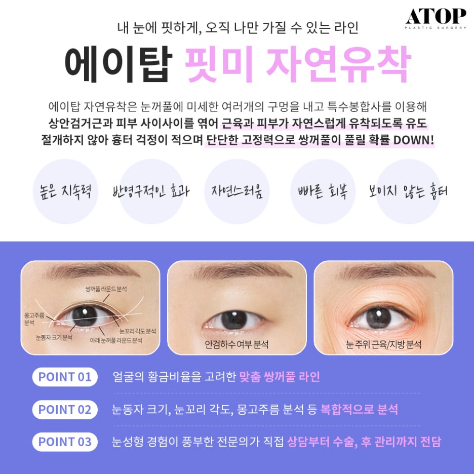 Natural Adhesion Double Eyelid Review: Confidence Boosted with a Face-Fitting Procedure image 2