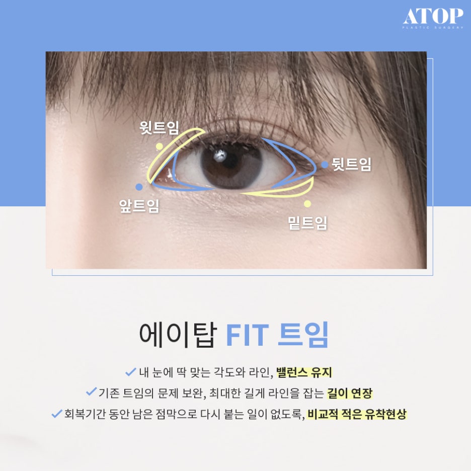강남쌍수잘하는곳 맞춤 디자인으로 핏하게 관련 이미지 4