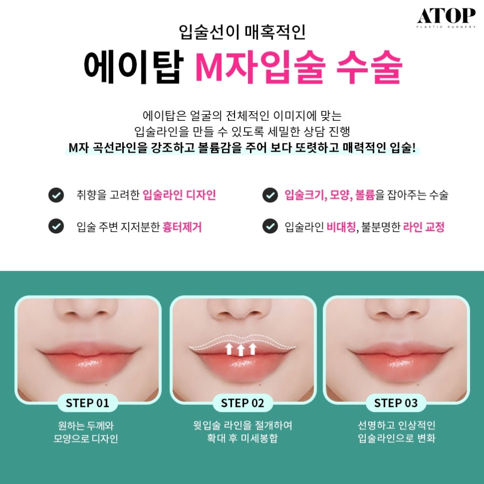 Gangnam Mouth Corner Surgery So Your Lips Match the Look You Want image 6