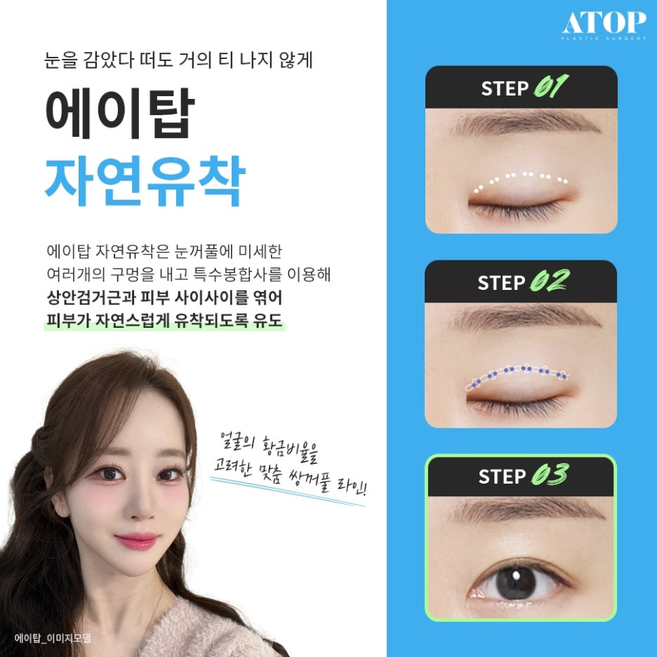 세미아웃라인자연유착 화려함과 자연스러움을 함께 관련 이미지 3