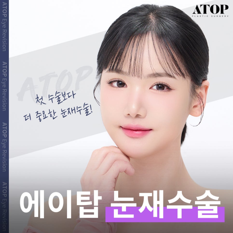 Double Eyelid Revision Surgery Review: No More Repeated Problems image 1