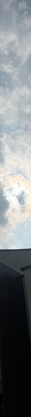 인중축소후기 인중 길이 고민 해소 관련 이미지 25