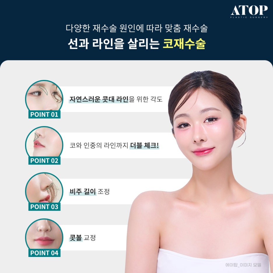 코재수술병원 변형된 코 원래 모습대로 관련 이미지 6