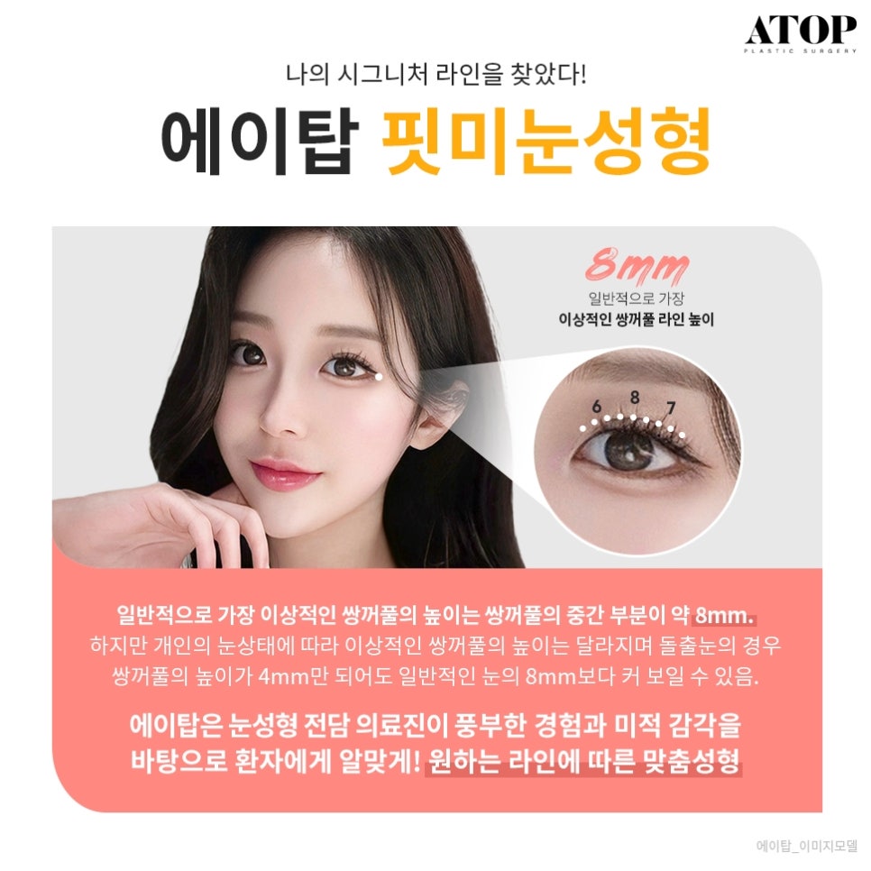 자연유착쌍수후기 핏한 쌍꺼풀과 트임으로 자연스럽게 관련 이미지 2