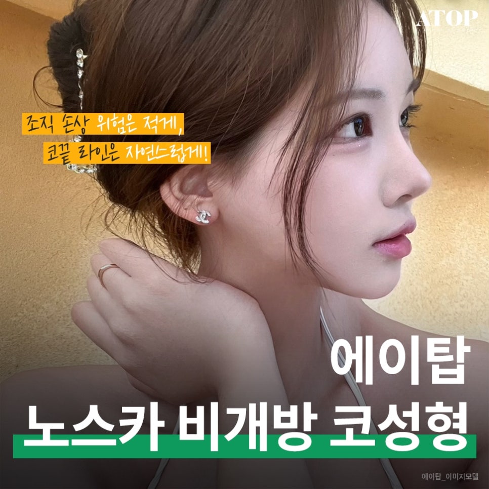 비절개코성형후기 흉터를 감춰 자연스러운 모습 관련 이미지 1