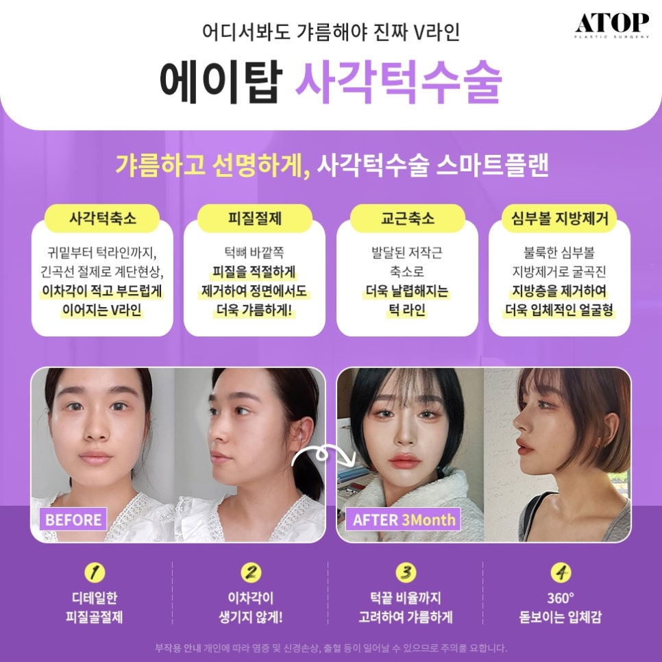 Gangnam Facial Contouring 3-in-1: A Soft, Smooth Line image 4
