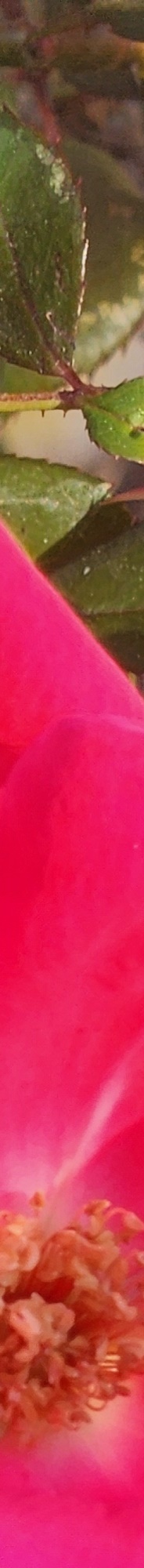Gangnam Mouth Corner Surgery So Your Lips Match the Look You Want image 14