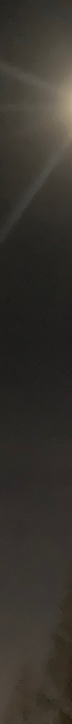 입꼬리수술잘하는곳 러블리한 입매가 될 수 있게 관련 이미지 14