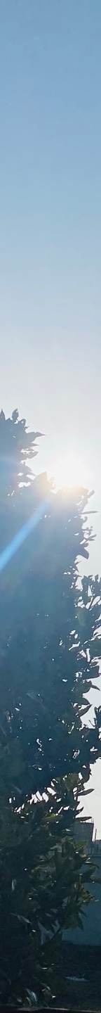 처진눈수술 중년의 눈을 또렷하게 관련 이미지 11