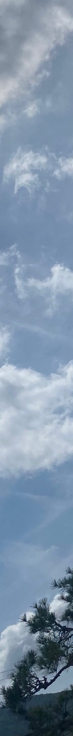 쌍수재수술가격 자연스러운 눈으로 관련 이미지 13