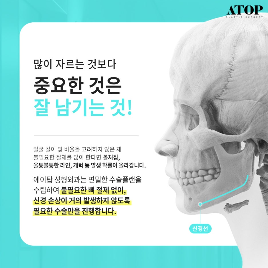 광대축소후기 크고 울퉁불퉁한 얼굴형 개선 관련 이미지 2