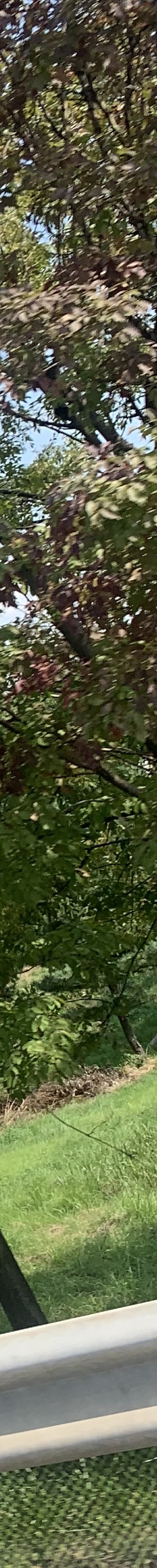 무턱보형물수술 자연스럽게 이어지는 윤곽 라인 관련 이미지 18