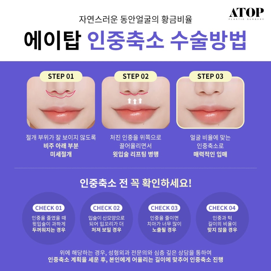인중축소재수술 비율에 맞는 디자인으로 관련 이미지 5