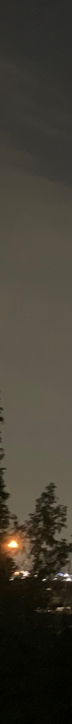 코재수술병원 변형된 코 원래 모습대로 관련 이미지 19