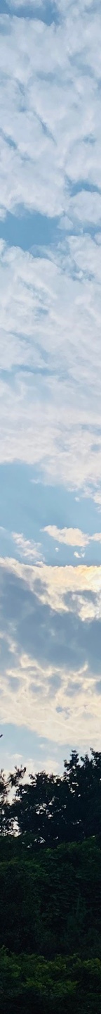 중년눈밑지방 눈꺼풀이 계속 처진다면? 관련 이미지 21