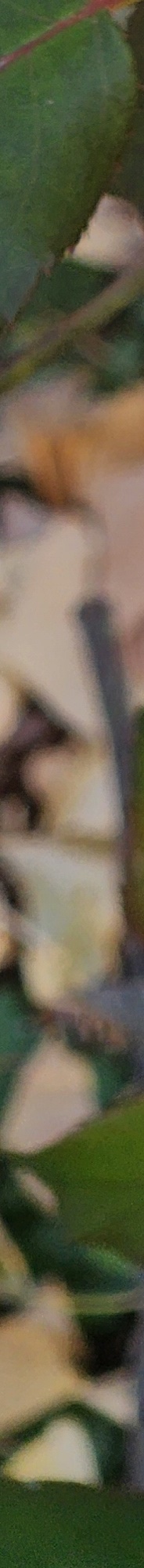 Double Eyelid Revision Surgery, My Own Money, Final Eye Plastic Surgery image 14