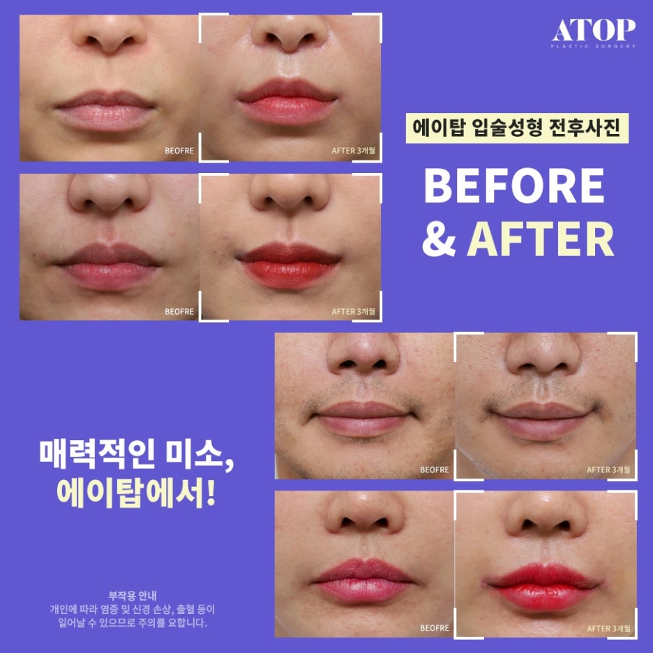 인중축소재수술 비율에 맞는 디자인으로 관련 이미지 7