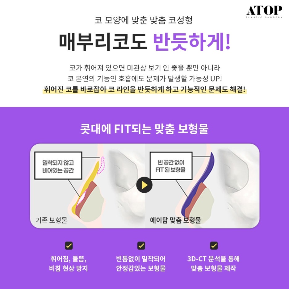 매부리코수술후기 내게 맞는 코 모양을 찾아 관련 이미지 6