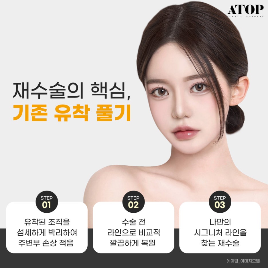 눈재수술병원 내 눈에 집중한 맞춤 수술 관련 이미지 3
