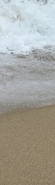 인중코성형후기 내 코에 맞는 핏한 수술 관련 이미지 26