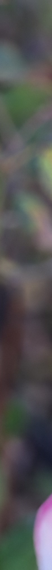 인중축소후기 비율에 맞는 예쁜 입술라인을 위해 관련 이미지 20