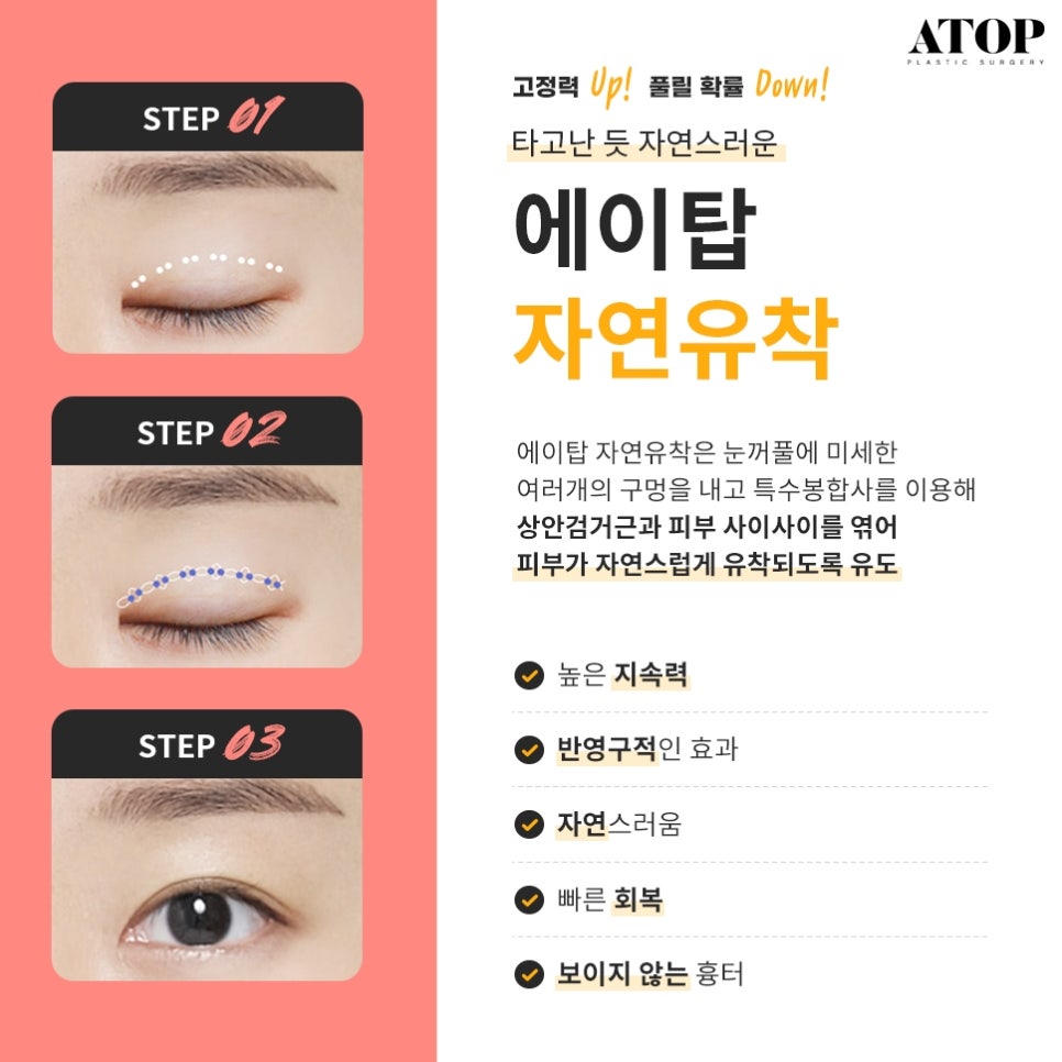 자연유착쌍수후기 핏한 쌍꺼풀과 트임으로 자연스럽게 관련 이미지 3