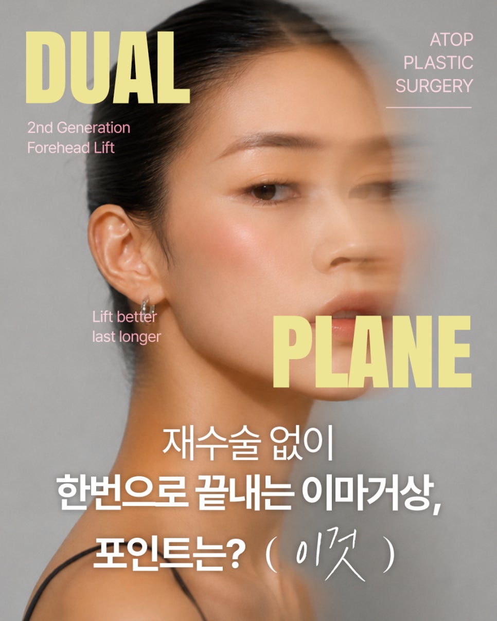 The 5-Point Incisions Remain the Same, but the Dissection Planes Are Different｜Second-Generation Dual-Plane Forehead Lift image 1