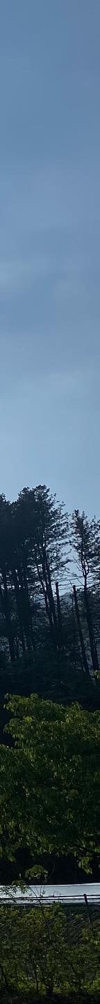 무턱보형물수술 자연스럽게 이어지는 윤곽 라인 관련 이미지 28