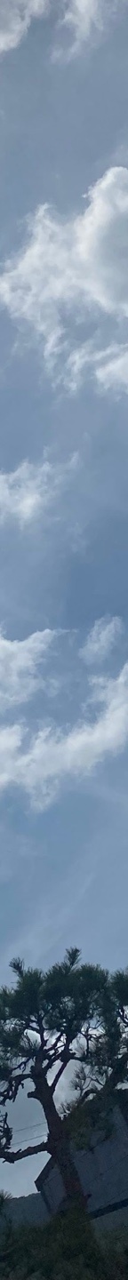 쌍수재수술가격 자연스러운 눈으로 관련 이미지 14