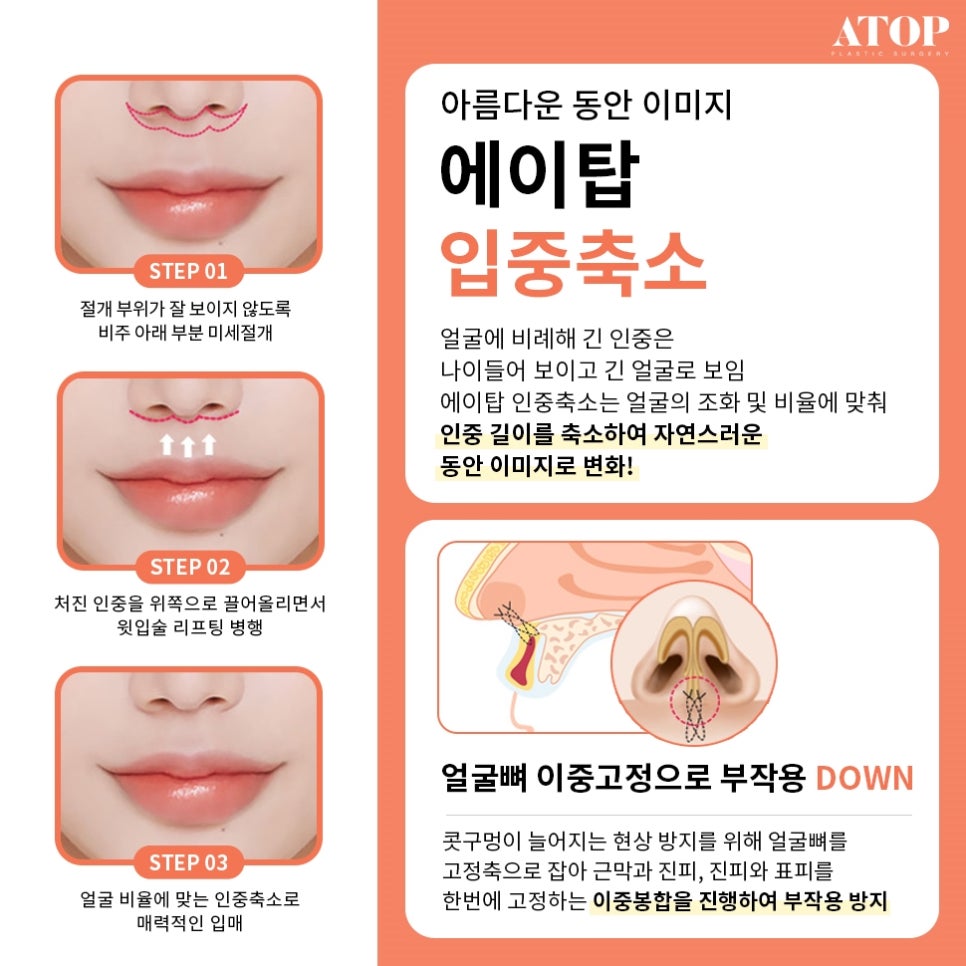 인중축소후기 비율에 맞는 예쁜 입술라인을 위해 관련 이미지 4