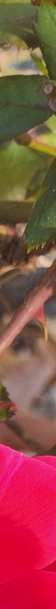 Double Eyelid Revision Surgery, My Own Money, Final Eye Plastic Surgery image 26