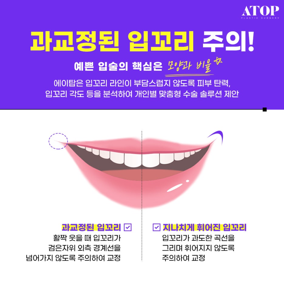 입꼬리수술내돈내산 위치 자체가 교정돼 더 자연스러워 관련 이미지 4