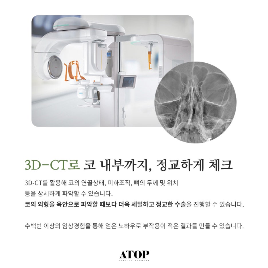 눈코성형비용  이목구비 조화로운 맞춤 디자인으로 관련 이미지 4