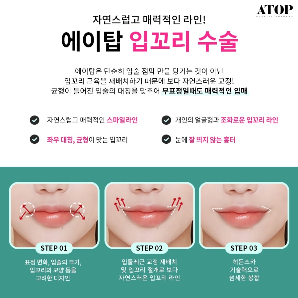 Gangnam Mouth Corner Surgery So Your Lips Match the Look You Want image 4