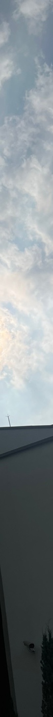 인중축소후기 인중 길이 고민 해소 관련 이미지 26