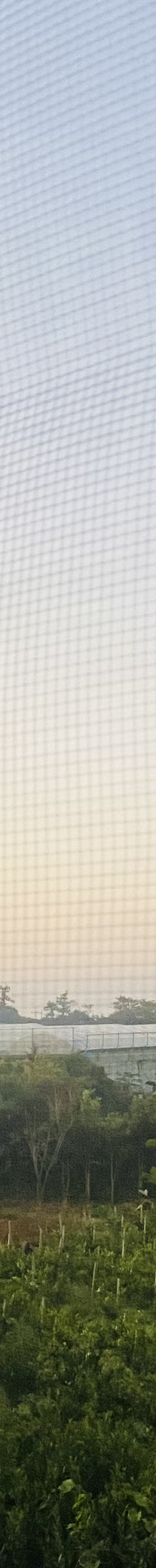남자코성형잘하는곳 옆라인 살리는 자연스러움 관련 이미지 23