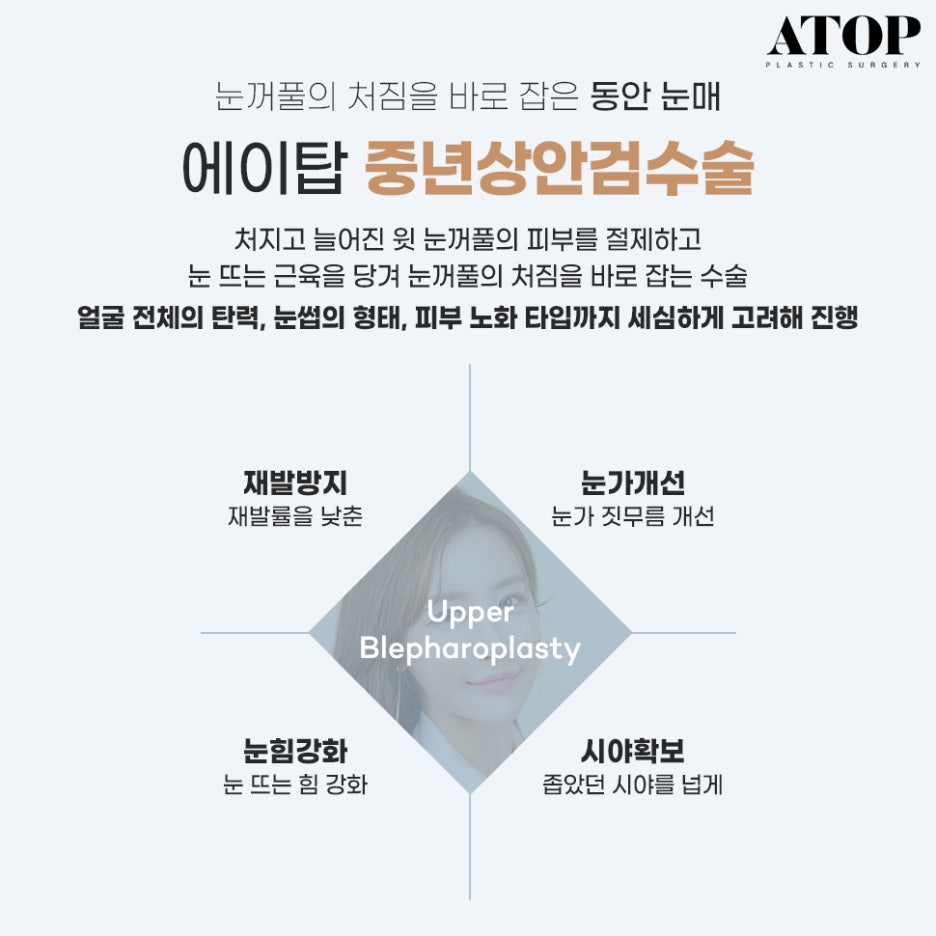중년눈밑지방 눈꺼풀이 계속 처진다면? 관련 이미지 2