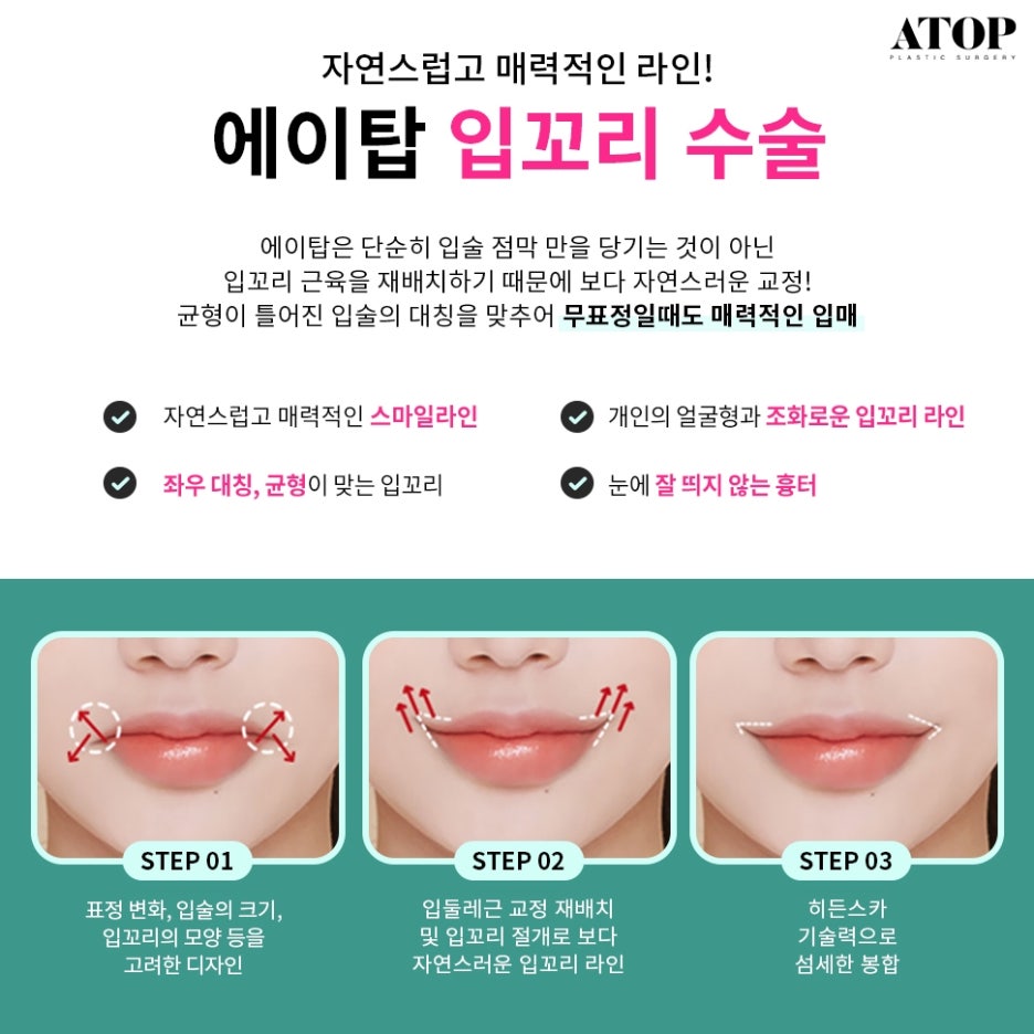 강남인중축소수술 또렷한 옆라인 관련 이미지 4