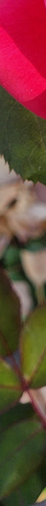 Double Eyelid Revision Surgery, My Own Money, Final Eye Plastic Surgery image 16