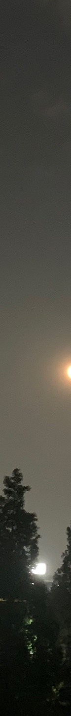 코재수술병원 변형된 코 원래 모습대로 관련 이미지 24