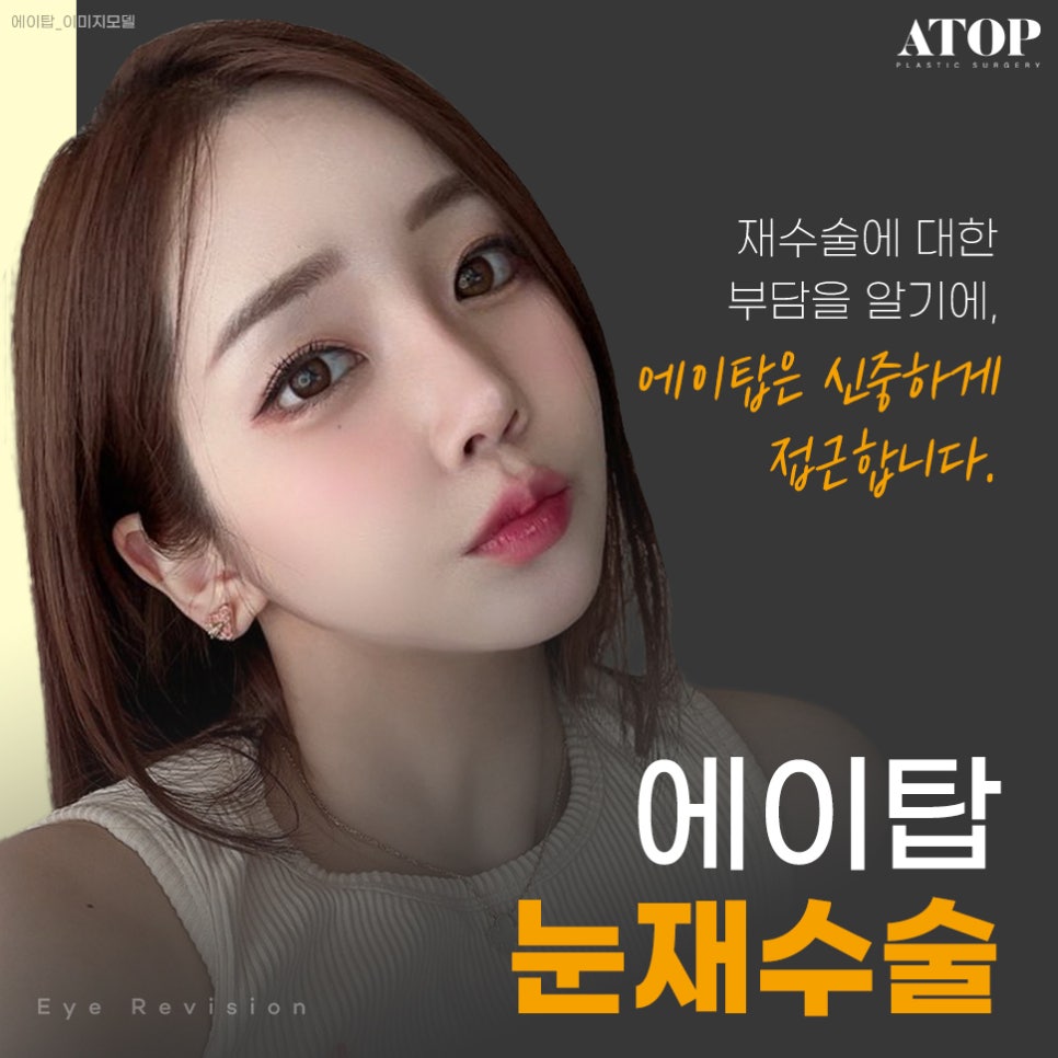 소세지눈재수술후기 소세지눈, 겹주름 해결하려면? 관련 이미지 1
