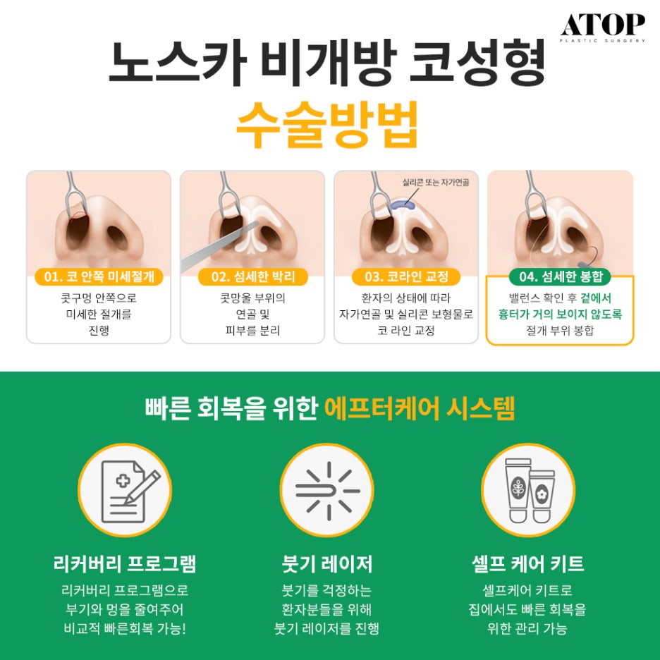 To Avoid Worrying About Scars from Closed Rhinoplasty image 5